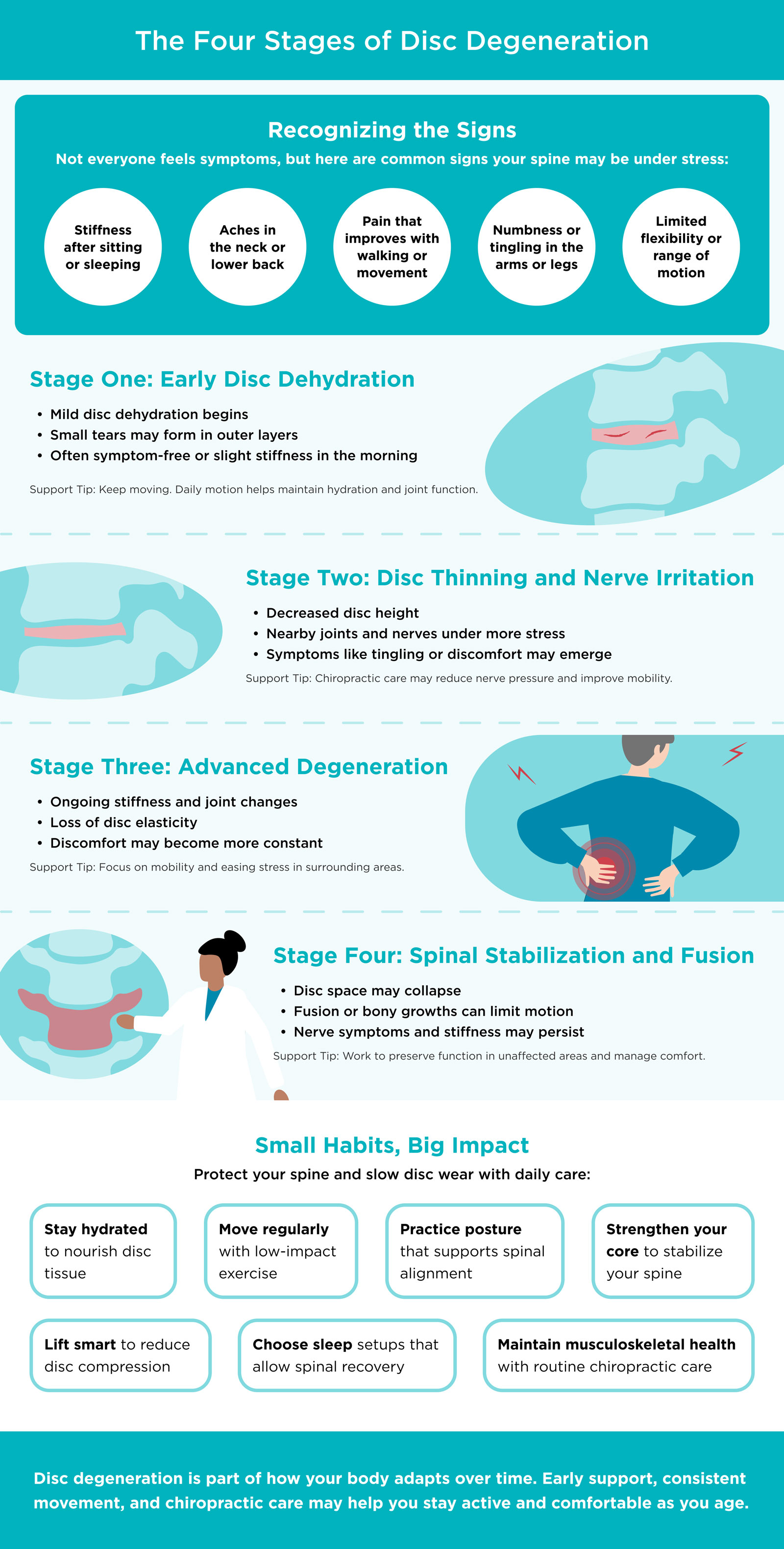 Infographic Featuring the Four Stages of Disc Degeneration